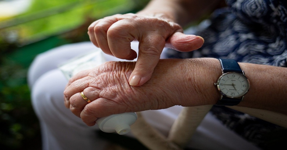 Manos de una mujer mayor con probabilidad de padecer de artritis o artrosis